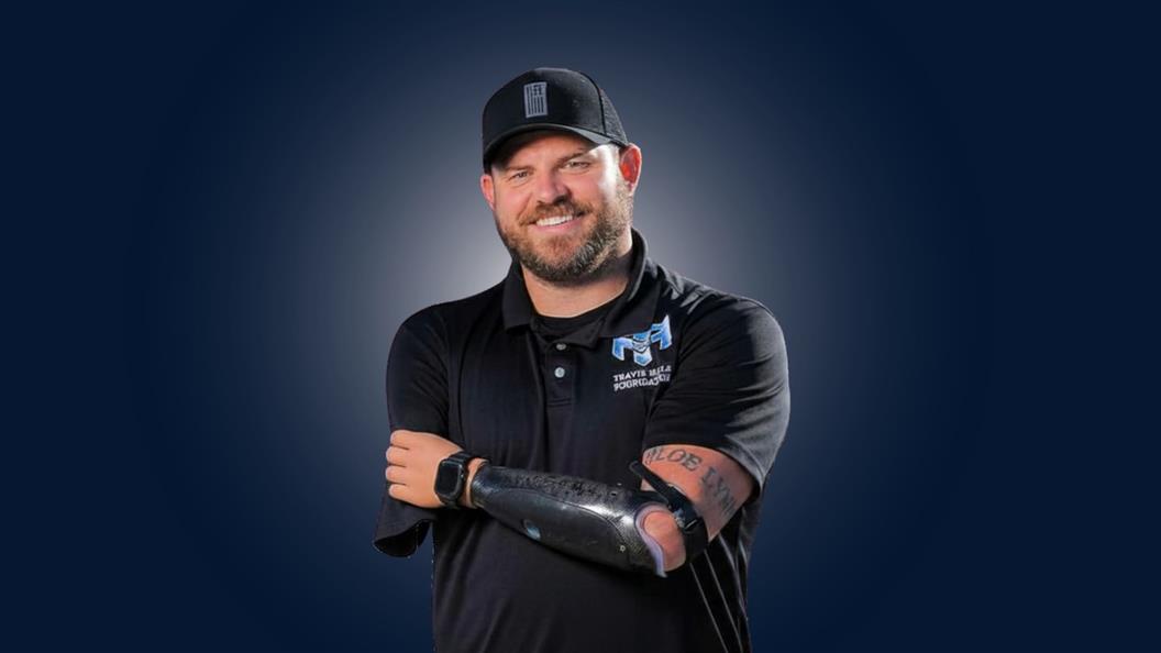 Person in a black polo shirt and cap, smiling with arms crossed, against a blue background. A prosthetic arm is visible.